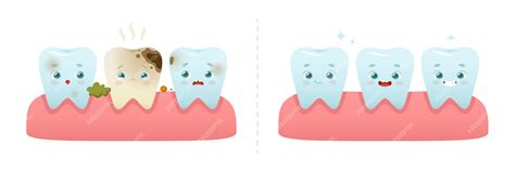 Vergleich von gesunden Zähnen und Zähnen mit MIH