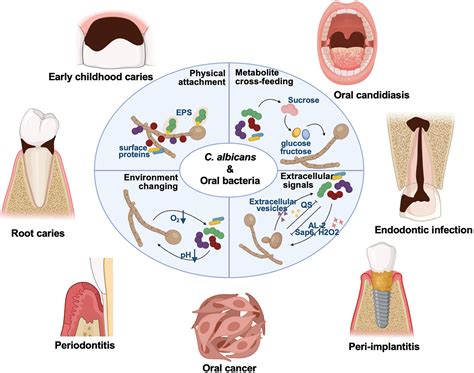 Schema zur Übertragung von Candida albicans zwischen Mutter und Baby