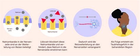 Schema der Wirkungsweise von Lidocain im Mundgel