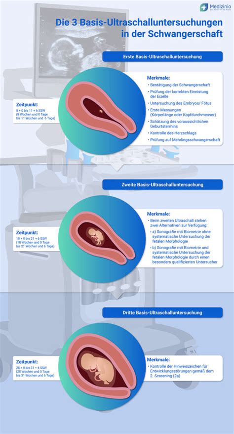 Infografik, die westliche Schlaferwartungen mit den physiologischen Schlafbedürfnissen von Babys vergleicht.