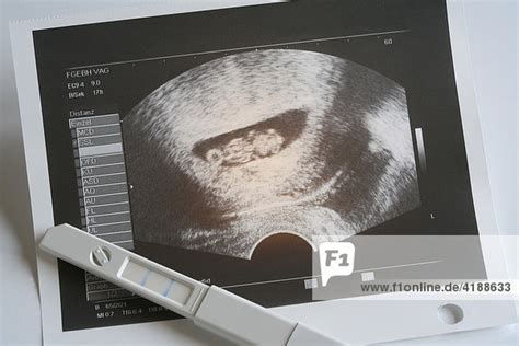 Ultraschallbild eines Fötus in der 9. Schwangerschaftswoche mit beginnenden Ohren