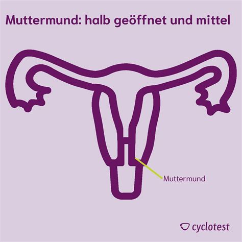 Vorher-Nachher-Vergleich des Muttermunds vor und nach der Geburt