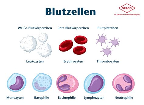 Schema der verschiedenen Arten von Menstruationsunregelmäßigkeiten