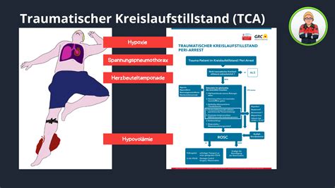 Infografik zu den häufigsten Ursachen für Kreislaufstillstand bei Kindern