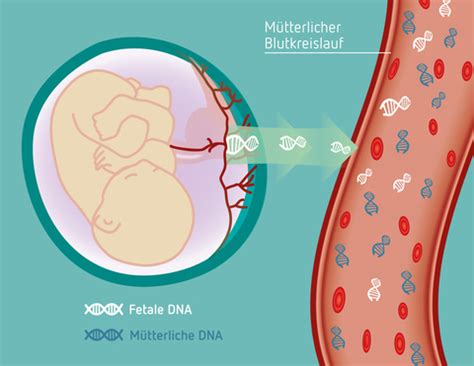 Infografik: Funktionsweise des Harmony-Tests durch Analyse der fetalen DNA im mütterlichen Blut