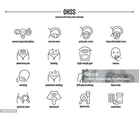 Infografik: Mögliche Symptome des Ovariellen Überstimulationssyndroms (OHSS)