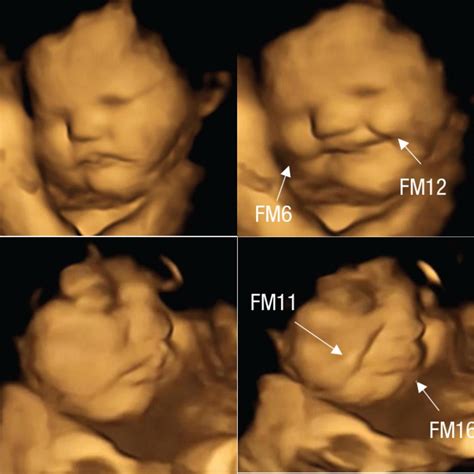 Illustration der Entwicklung des Gesichts eines Babys im Ultraschall, mit Fokus auf Augenbrauen und Wimpern.