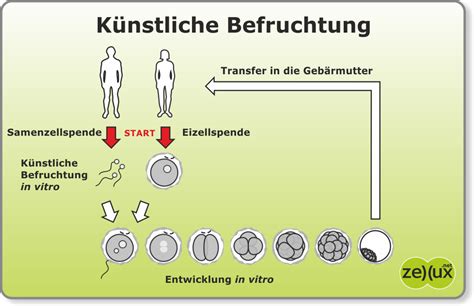 Schema, das den Prozess der Antragstellung und Genehmigung einer künstlichen Befruchtung bei der DAK Gesundheit darstellt, inklusive der Notwendigkeit einer schriftlichen Zusage