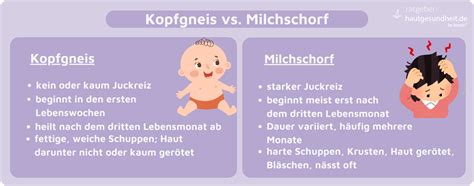 Schema der Anwendung von Kopfgneis Milchschorf Shampoo