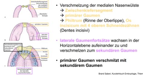 Vergleichsgrafik: Entwicklung des Gaumens mit herkömmlichem Schnuller vs. Curaprox-Schnuller
