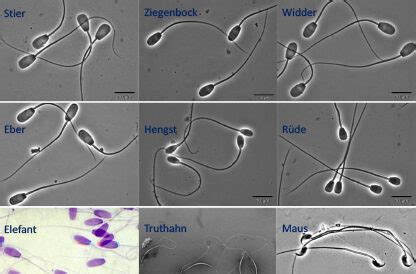 Mikroskopische Aufnahme von Spermien, die für die IUI-Behandlung aufbereitet werden.