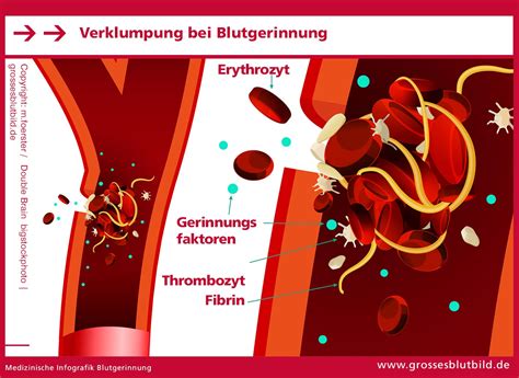 Schema zur Wirkung von ASS auf die Blutgerinnung