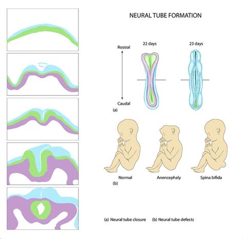 Darstellung der Entwicklung des Neuralrohrs und möglicher Defekte