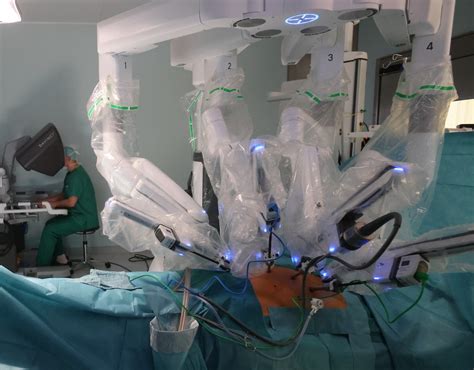 Darstellung des Da Vinci Operationsroboters