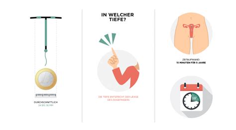 Illustration des Einsetzens einer Hormonspirale durch einen Gynäkologen