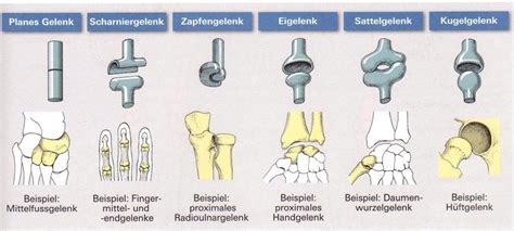 Beispiele für verschiedene Arten von Nagelkorrekturspangen