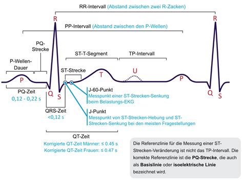 Schematische Darstellung der EKG-Kurve mit Beschriftung der einzelnen Wellen und Strecken (P, PQ, QRS, ST, T, U)