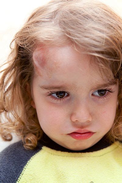 Kleinkind mit Beule am Kopf, das von einer besorgten Mutter getröstet wird.