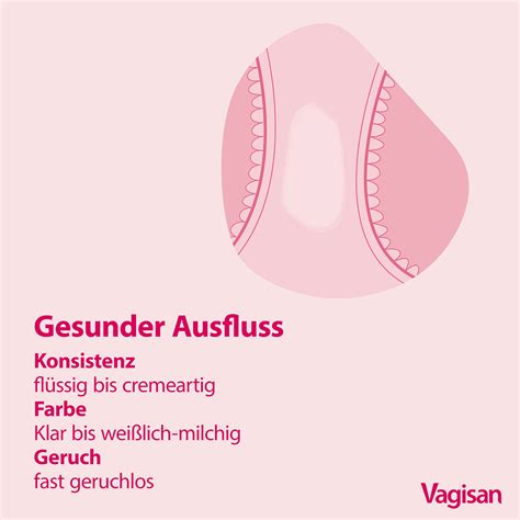 Gegenüberstellung von gesundem und infiziertem Vaginalsekret (Farbe, Konsistenz, Geruch)
