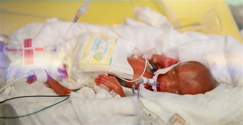 Symbolbild: Frühchen auf einer Säuglingsstation