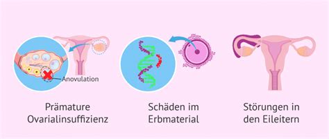 Infografik, die die verschiedenen Optionen zur Erhaltung der Fruchtbarkeit bei Eierstockkrebs darstellt