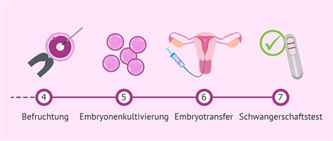 Grafik, die den Ablauf einer IVF-Behandlung veranschaulicht