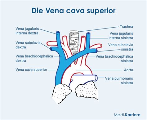 Schema der Vena cava und des Drucks in verschiedenen Schlafpositionen