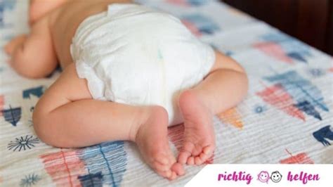 Baby mit einem roten, wunden Po, der mit einer Zinksalbe behandelt wird