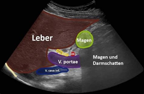 Schema der Scheitel-Steiss-Längenmessung per Ultraschall