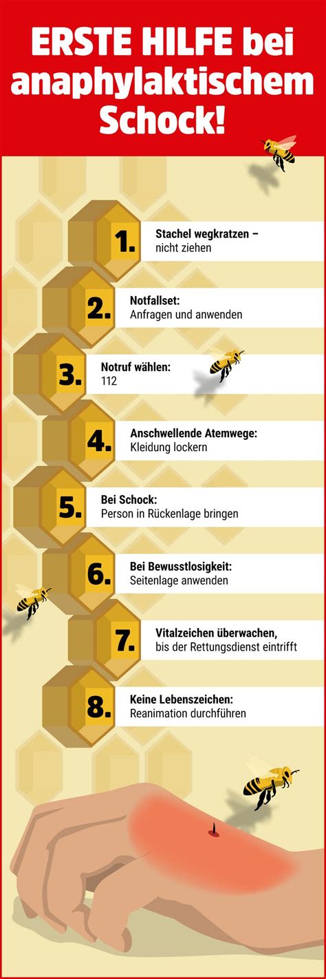 infografik mit den wichtigsten Erste-Hilfe-Maßnahmen bei Insektenstichen und Warnsignalen für allergische Reaktionen