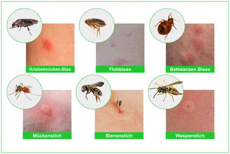 visuelle Darstellung von vorbeugenden Maßnahmen gegen Insektenstiche bei Kindern