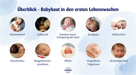 Grafik, die die Entwicklung des Magenvolumens eines Säuglings in den ersten Lebenswochen zeigt