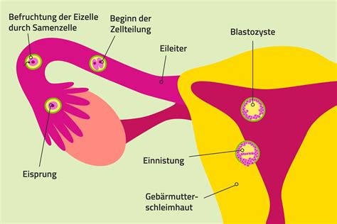 Schema des weiblichen Fortpflanzungssystems mit Hervorhebung der Gebärmutter und Eileiter, um das Konzept einer Eileiterschwangerschaft zu veranschaulichen.
