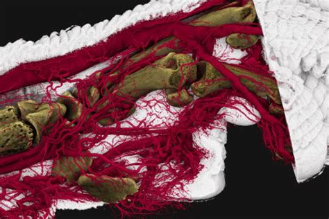 Schnitt durch einen Zahnkeim mit Darstellung von Nerven und Blutgefäßen