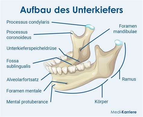 Illustration eines Zahnabszesses mit Eiteransammlung im Kieferknochen.