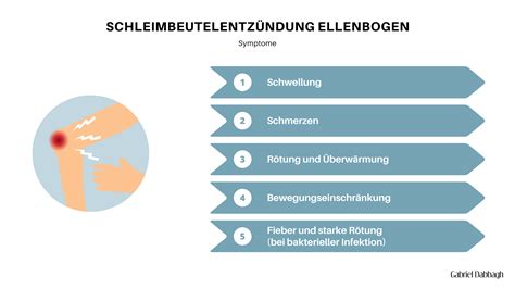 Grafik mit den typischen Symptomen eines Zahnabszesses: Schmerz, Schwellung, Rötung, Fieber.