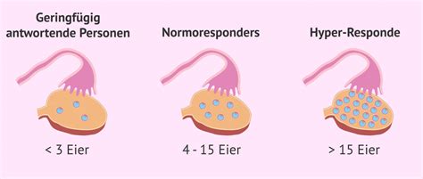 Schema der hormonellen Stimulation der Eierstöcke zur Eizellreifung