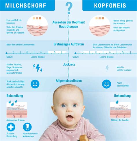 Schema zur Unterscheidung von Milchschorf und Kopfgneis