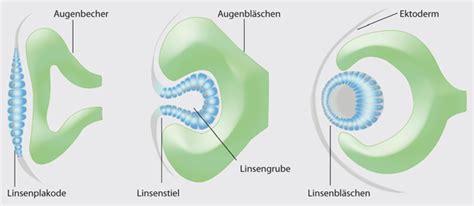 Schema der Augenentwicklung vom Augenbläschen bis zur Linsenbildung.