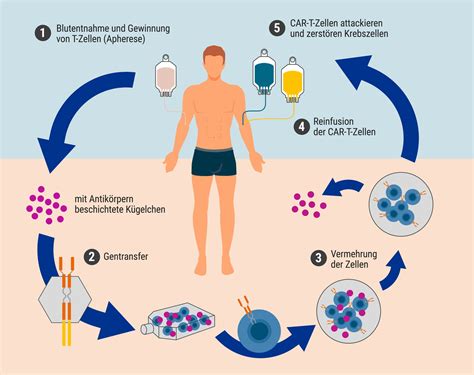 Grafik, die den Einfluss von Chemotherapie und Bestrahlung auf die Spermienproduktion zeigt