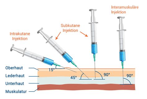 Schema zur Vorbereitung und Injektion eines Ovitrelle-Pens