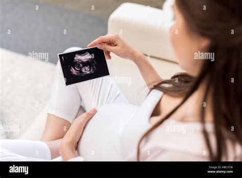 Illustration einer schwangeren Frau mit einem Ultraschallbild eines Babys