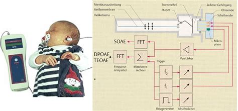 Illustration der Messung otoakustischer Emissionen (OAE)