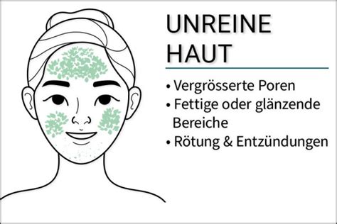 Grafik, die die Vorteile von nicht komedogener Hautpflege für unreine Haut hervorhebt.