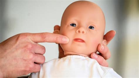 Charakteristische Merkmale eines Neugeborenen mit Trisomie 18: tiefsitzende Ohren, geballte Fäuste und Klumpfüße.