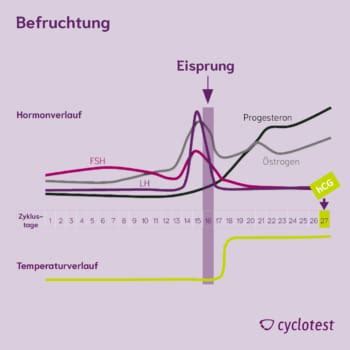 Schema der hCG-Produktion und -Veränderung während der frühen Schwangerschaft