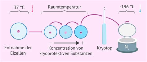 Vergleich der Erfolgsraten von Kryokonservierung und Frischtransfer