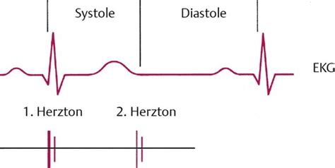 Schema eines CTG-Geräts mit den beiden Sonden für Herztöne und Wehen.